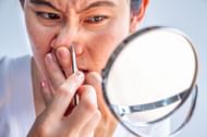 There are many factors that cause open comedones (Image via Getty)